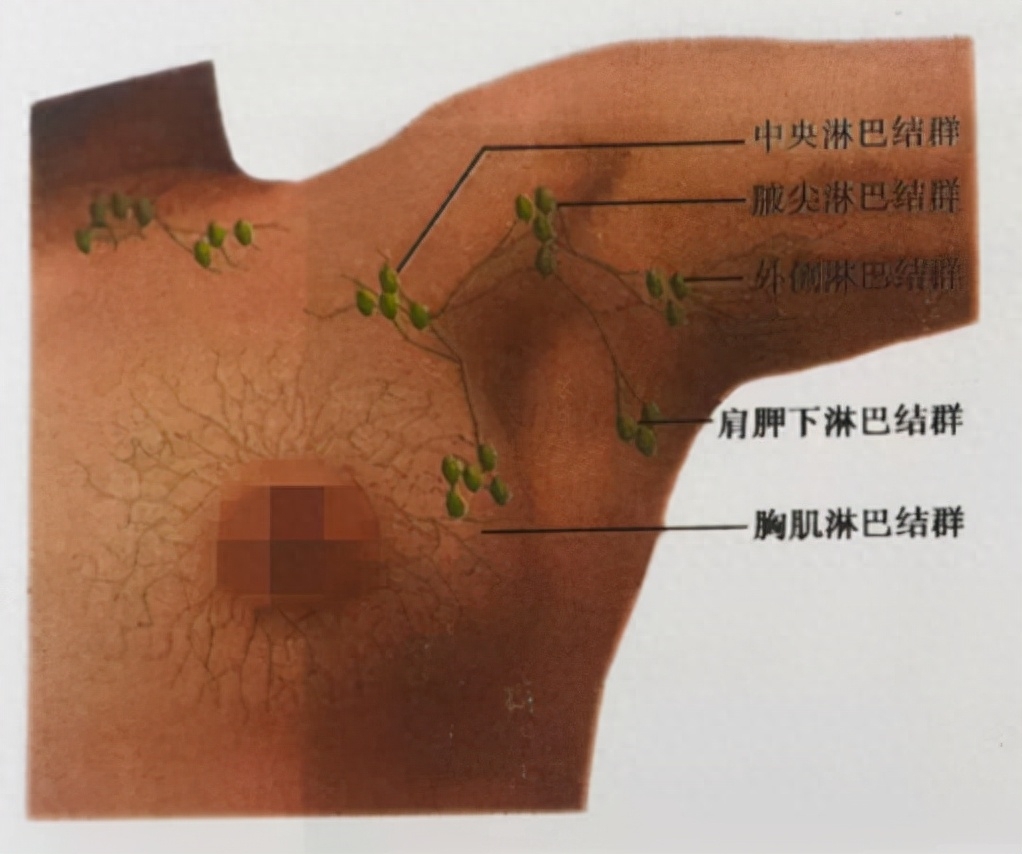 淋巴结肿大图片（教你自我判断肿大的淋巴结）