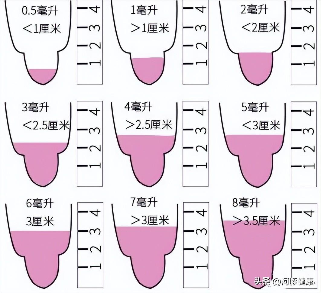 形态正常率多少是正常的（4大指标判断精子质量）