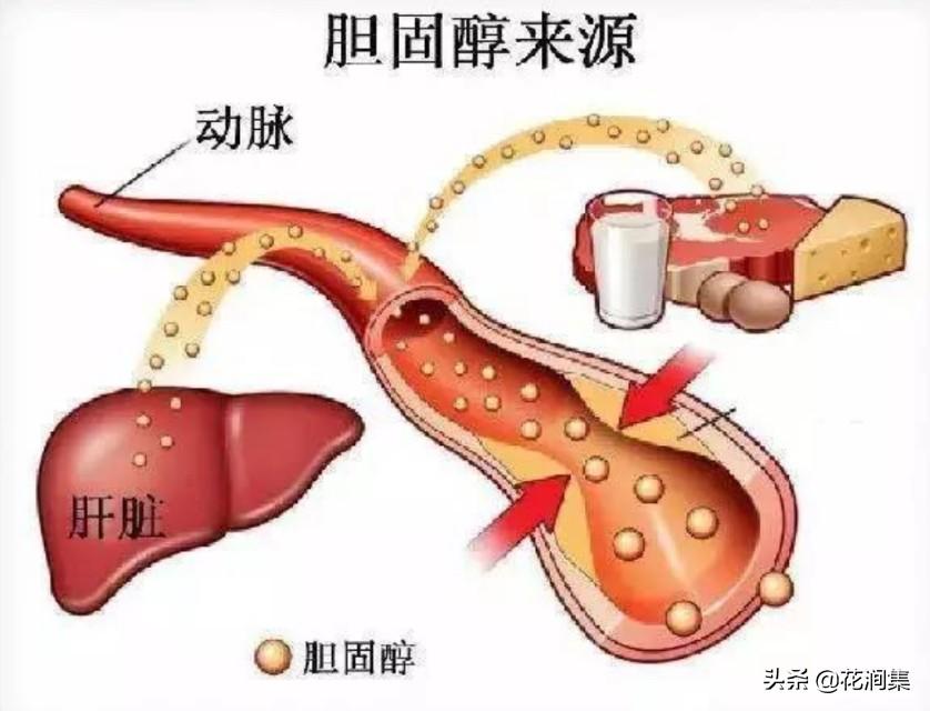 胆固醇高吃什么食物降得最快（帮你降低胆固醇的妙招）