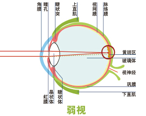 儿童结膜炎的症状（儿童常见的“四类”眼疾）